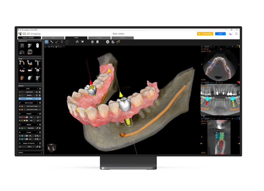 Écran de contrôle affichant le logiciel CS 3D Imaging